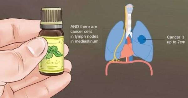 За рака и етеричните масла от първа ръка